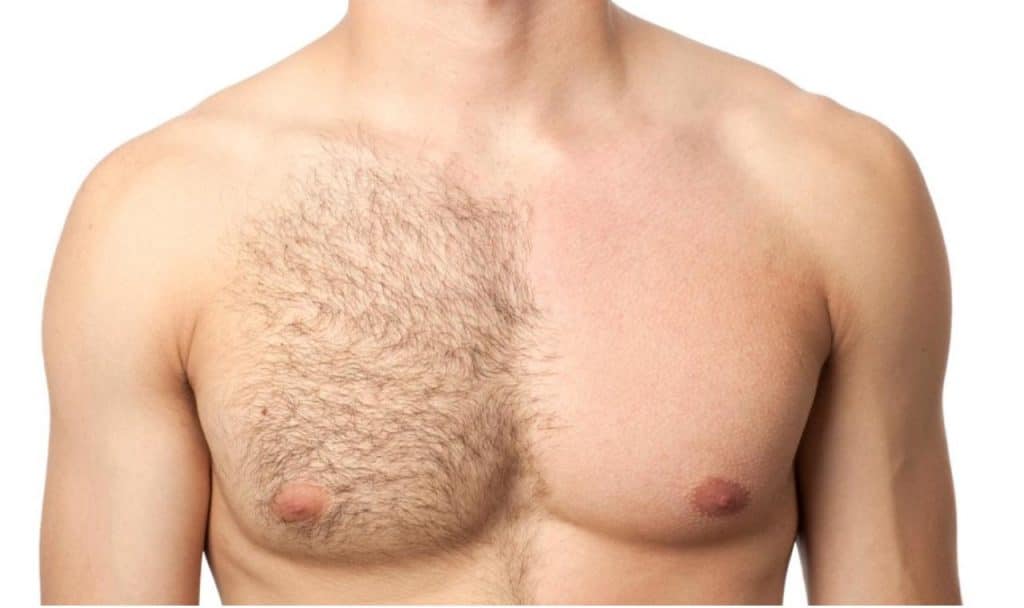 Epilation à lumière pulsée : Quels bénéfices pour le corps ?