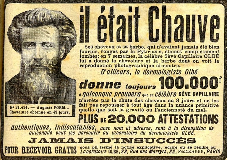Enfin une méthode efficace pour lutter contre la calvitie ?