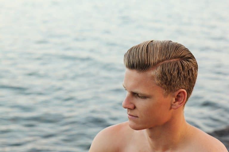 Les dangers de la greffe de cheveux